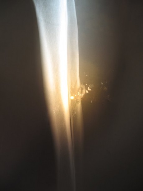 X-ray Ashraf's leg